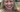 The Revolutionary Benefits of All on 4 Dental Implants