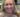 The Revolutionary Benefits of All on 4 Dental Implants