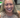 The Revolutionary Benefits of All on 4 Dental Implants