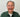The Most Effective Solution: All-on-4 Dental Implants