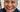 The Ultimate Guide to Dental All On 4 Dentures