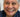 The Ultimate Guide to Dental All On 4 Dentures