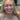 The Revolutionary Benefits of All on 4 Dental Implants