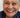 The Ultimate Guide to Dental All On 4 Dentures